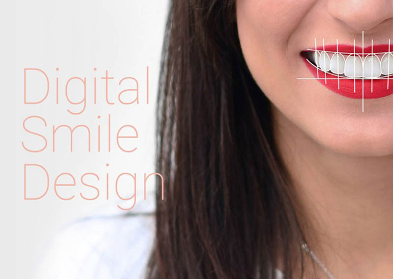 DIGITAL SMILE DESIGN