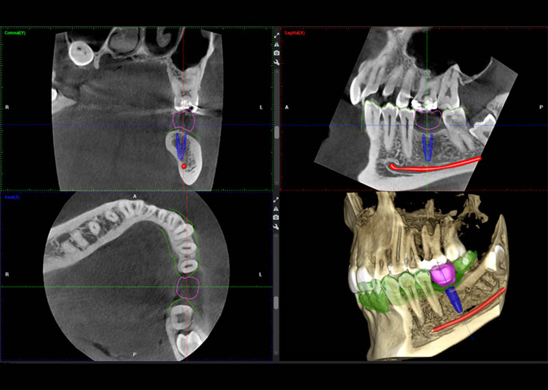 RADIOLOGIA DIGITALE 3D