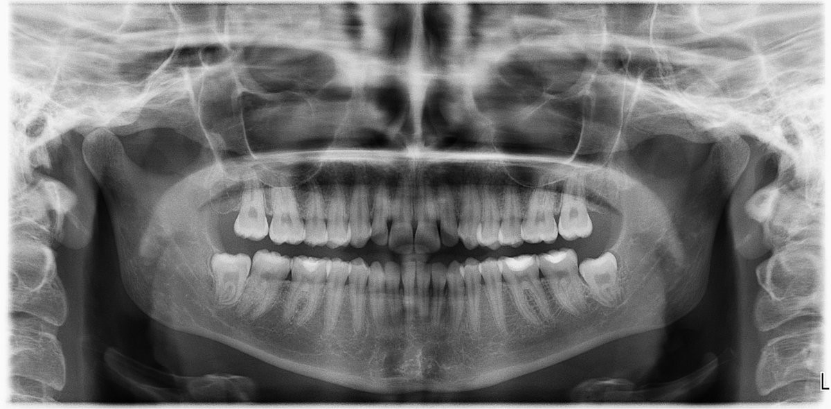 RADIOGRAFIA PANORAMICA