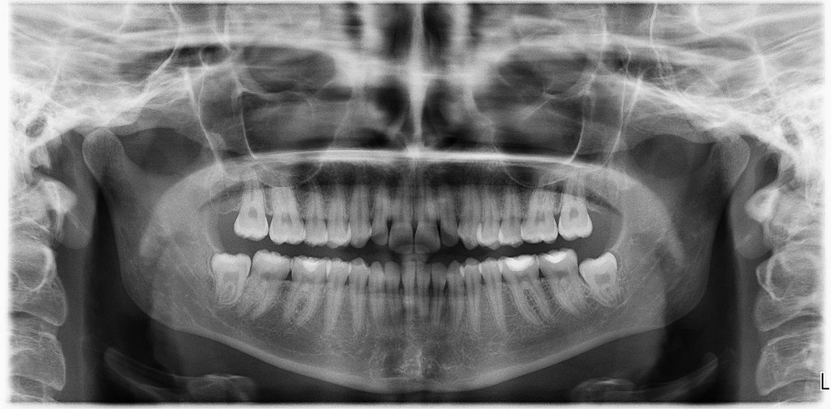 RADIOGRAFIA PANORAMICA