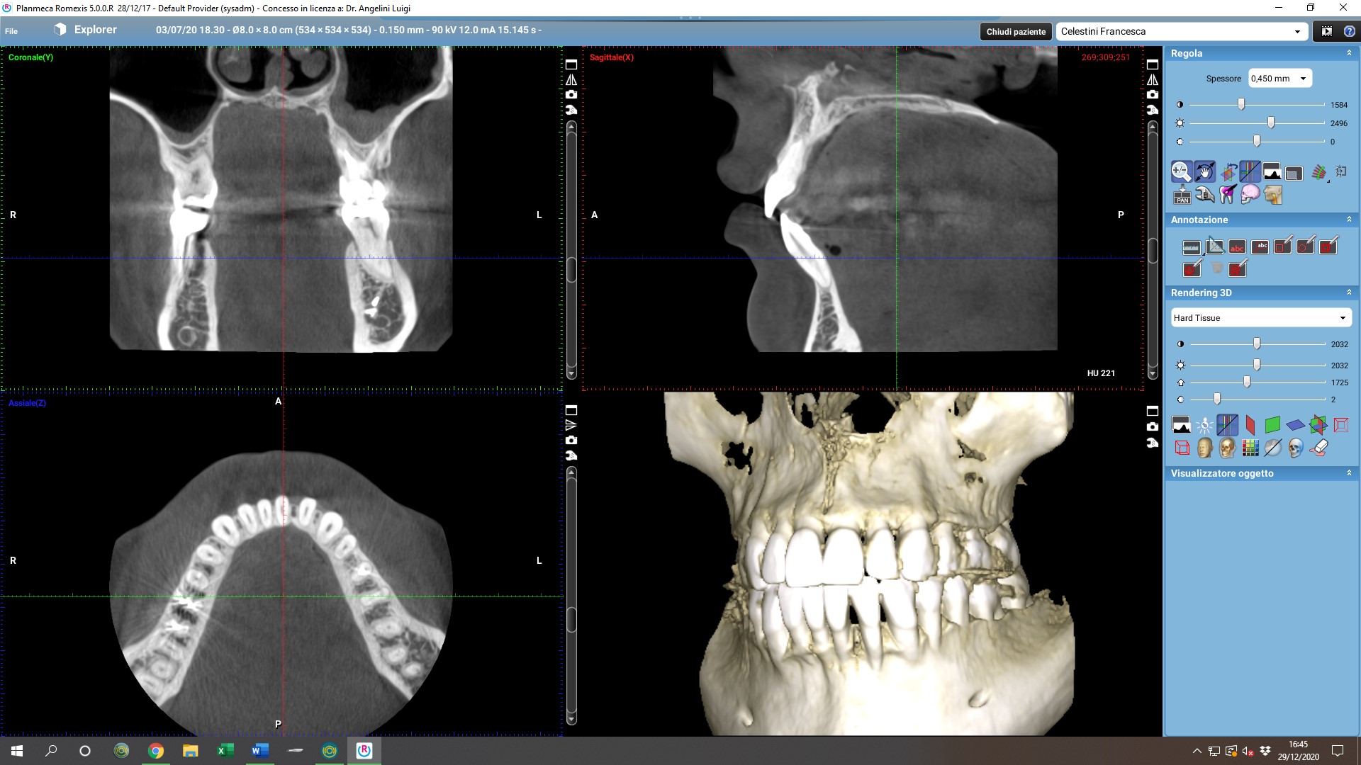 RADIOGRAFIA 3D