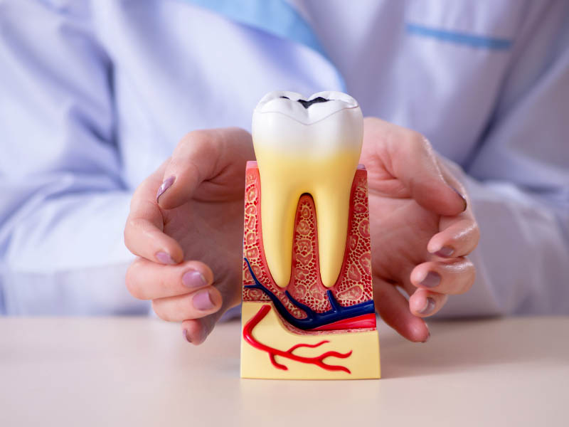 Paradontologia Cure e trattamenti per Gengivite Parondotite Teramo e provincia